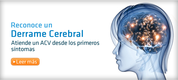 Reconoce a un derrame cerebral