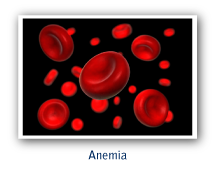 anemia