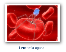 Leucemia aguda