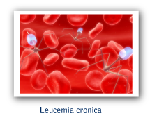 Leucemia crónica
